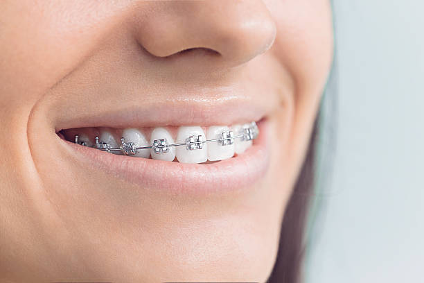 Best Teeth Whitening  in Moscow, PA